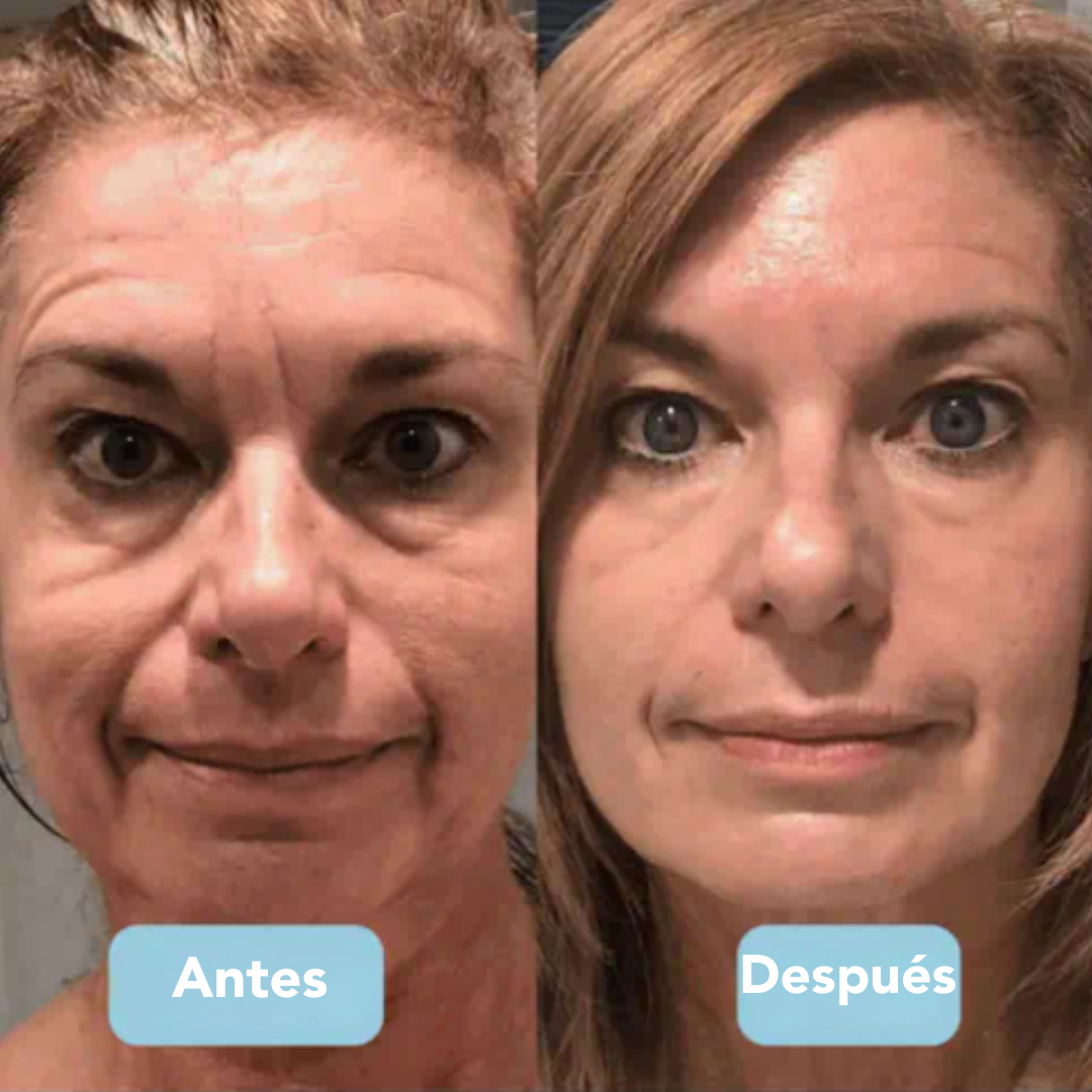 TENSY 3-en-1 Escultor Facial LED