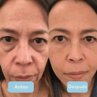 TENSY 3-en-1 Escultor Facial LED