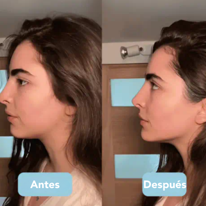 TENSY 3-en-1 Escultor Facial LED